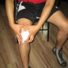 Home Care and Proper Burn Management Burn
